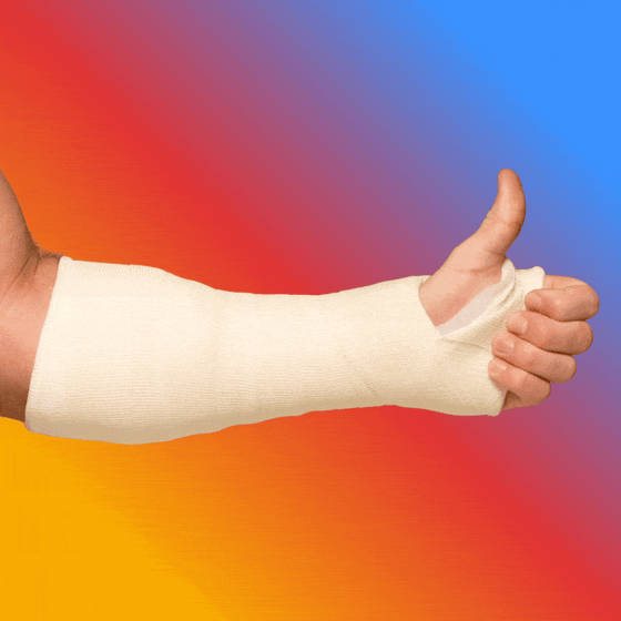 Someone gives a 'thumbs up' sign while their arm is in a cast.