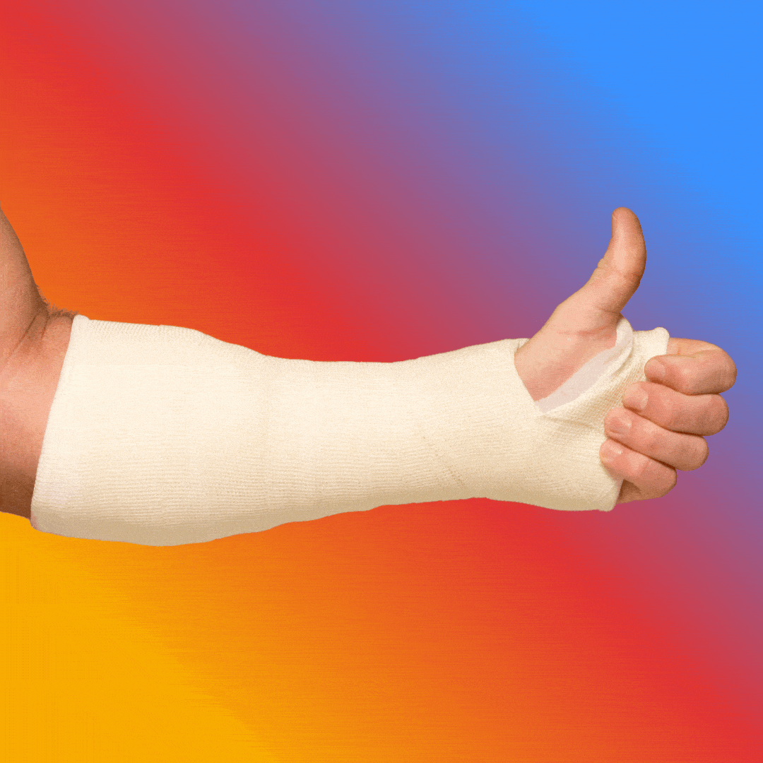 Someone gives a 'thumbs up' sign while their arm is in a cast.