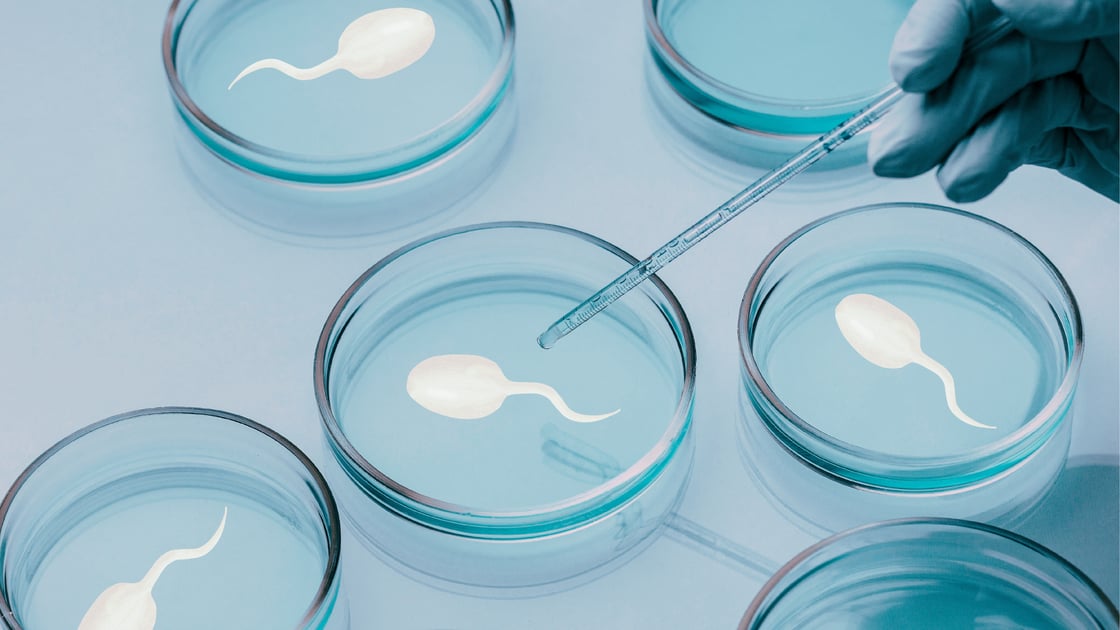 Several sperm cells in petri dishes