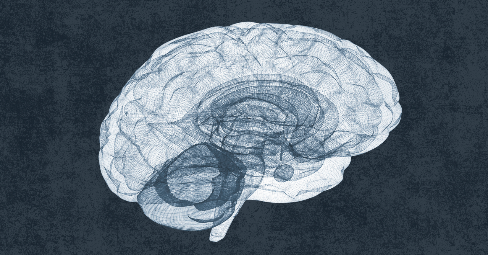 This is your brain. This is your brain on ultrasound. Any questions?